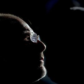 Anistia Política: O que significa?